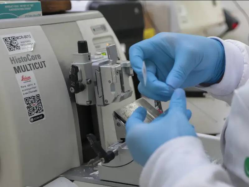 Cura de câncer de próstata pode chegar a até 98%