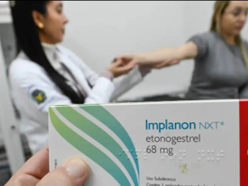 SUS qualifica profissionais para ampliar oferta de implantes hormonais