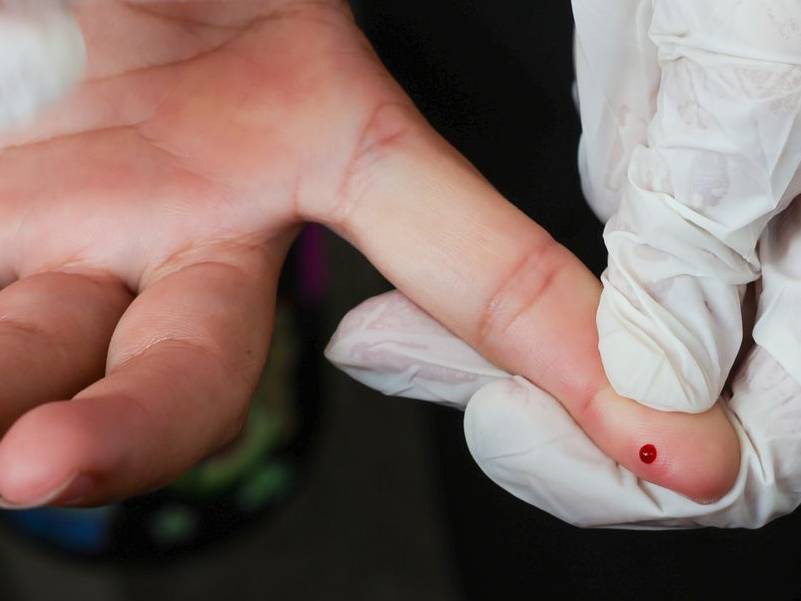 SUS passa a oferecer teste rápido de dengue