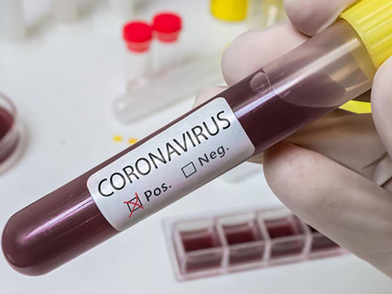 Marília tem primeira morte por coronavírus, e número de casos confirmados sobe para 2