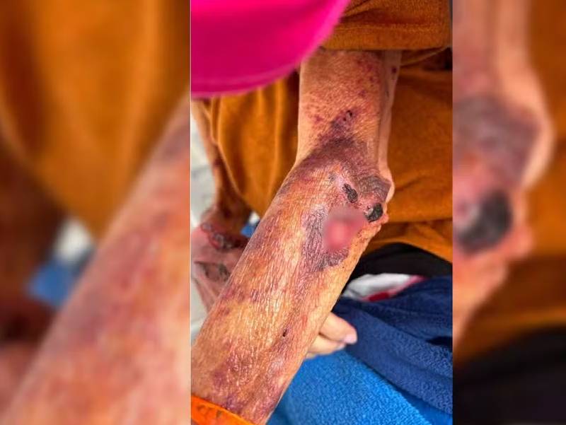 Mulher é presa suspeita de manter a mãe idosa em situação de desnutrição e maus-tratos em Arealva