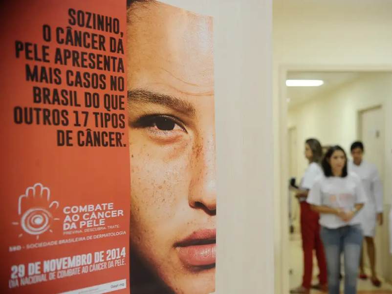 Casos de câncer de pele saltam de 4 mil para mais de 72 mil em 10 anos