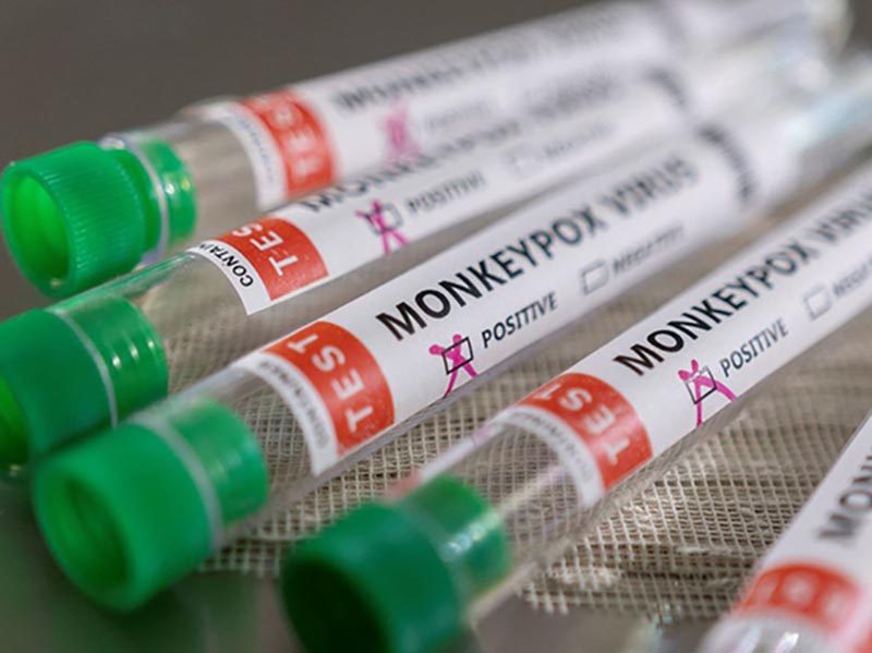 SP confirma mais dois casos de varíola dos macacos no estado
