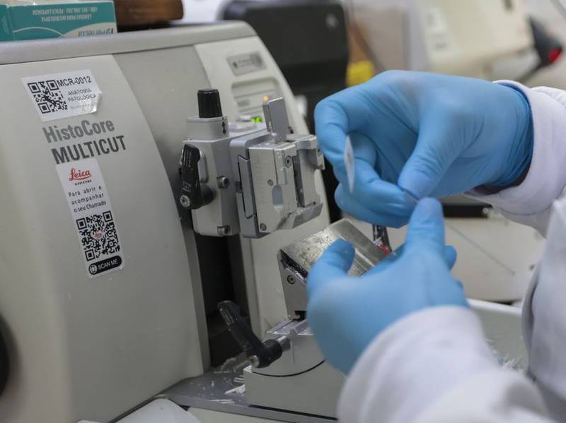 SUS inclui nova terapia para pacientes adultos com leucemia mieloide