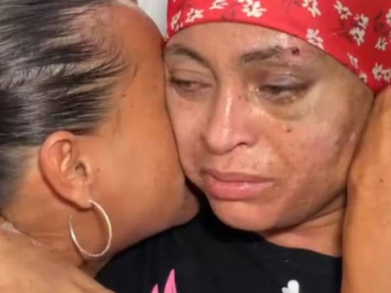 Mulher dada como morta por engano após atropelamento recebe alta e deixa hospital em Bauru