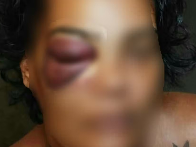 Polícia Militar investiga denúncia de mulher agredida durante abordagem em Botucatu