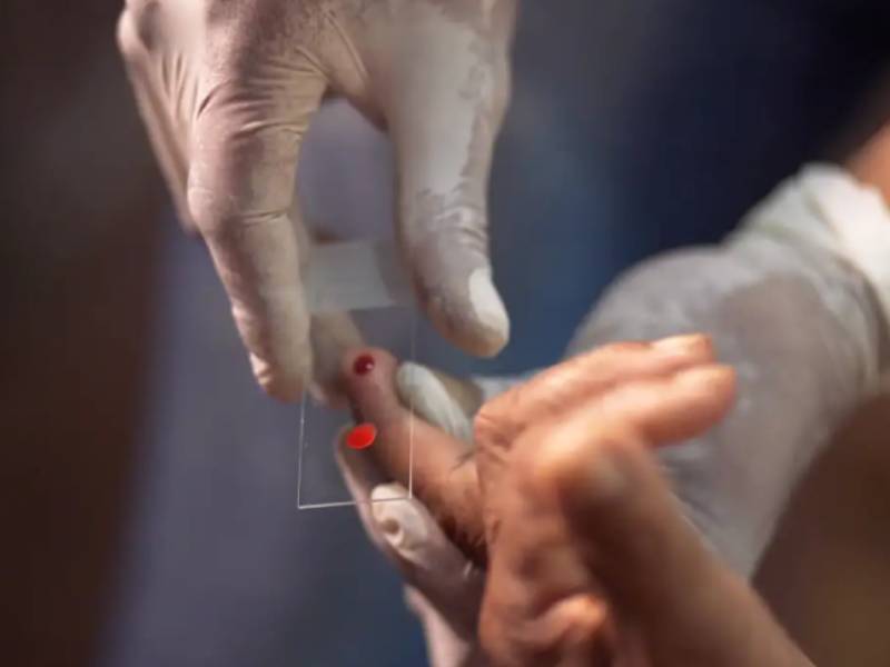 SUS começa a usar novo tratamento contra a malária em crianças