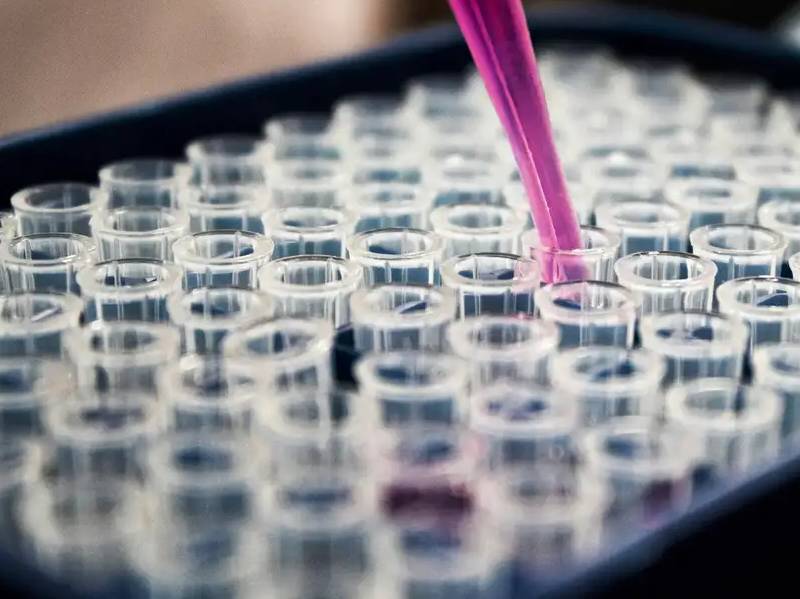 Estudo mostra que inflamação no cérebro pode ser chave do Alzheimer