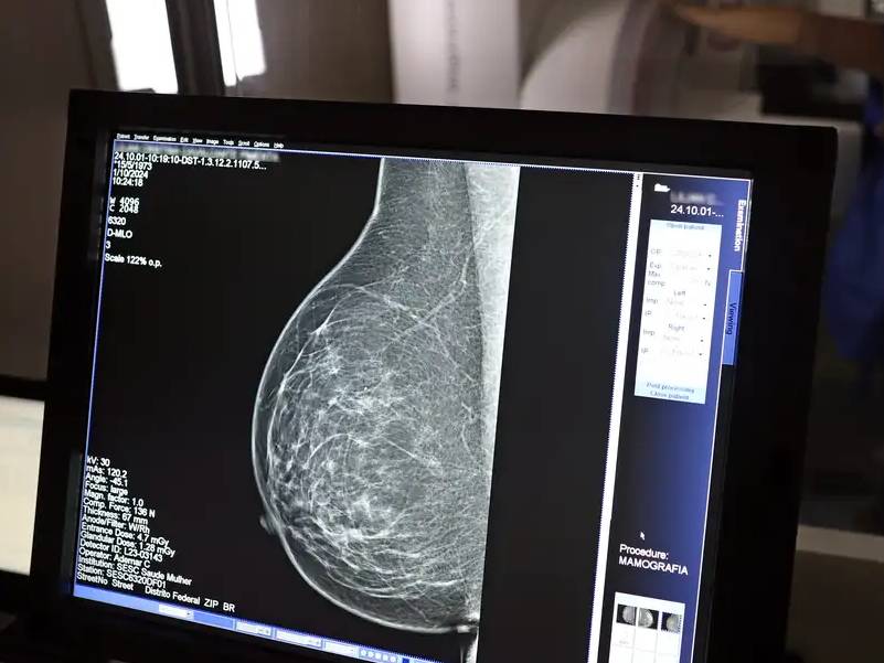 Nova lei reforça direito a três folgas por ano para exames preventivos