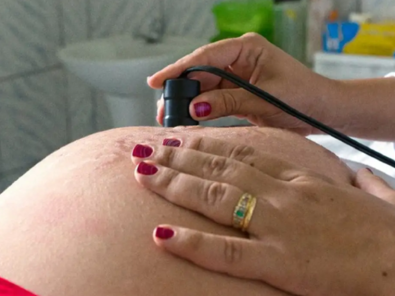 Assistência ao parto avança no Brasil, mas pré-natal ainda preocupa