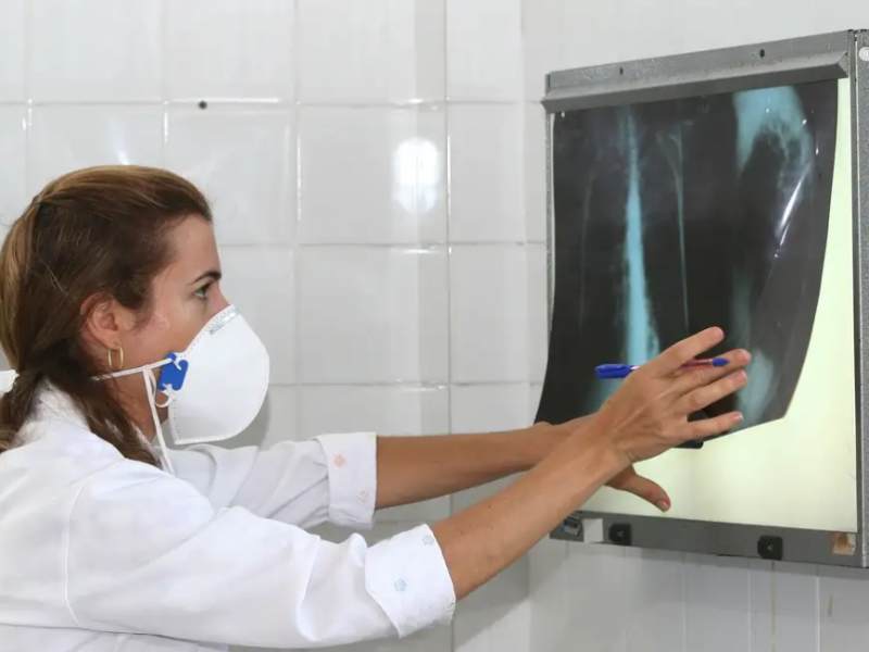 OMS recomenda testes de diagnóstico rápido para erradicar tuberculose