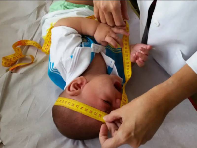 INSS pagará indenização de R$ 60 mil a crianças vítimas de zika