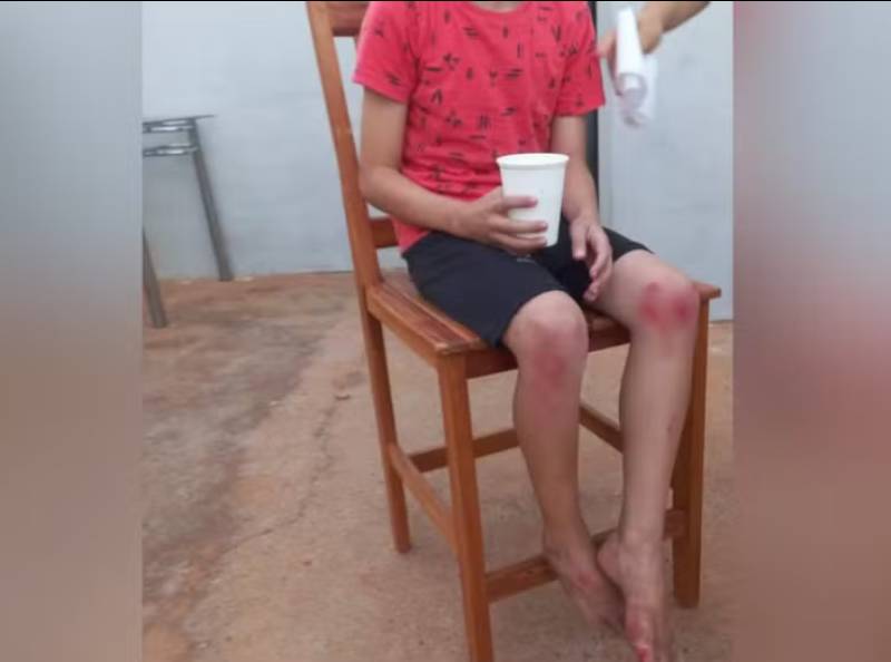 Menino de 8 anos é atropelado por moto enquanto jogava bola em frente de casa em Tupã