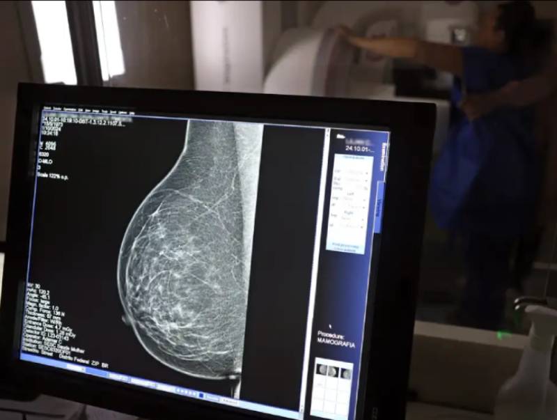 Ministério da Saúde passa a recomendar mamografia a partir dos 40 anos
