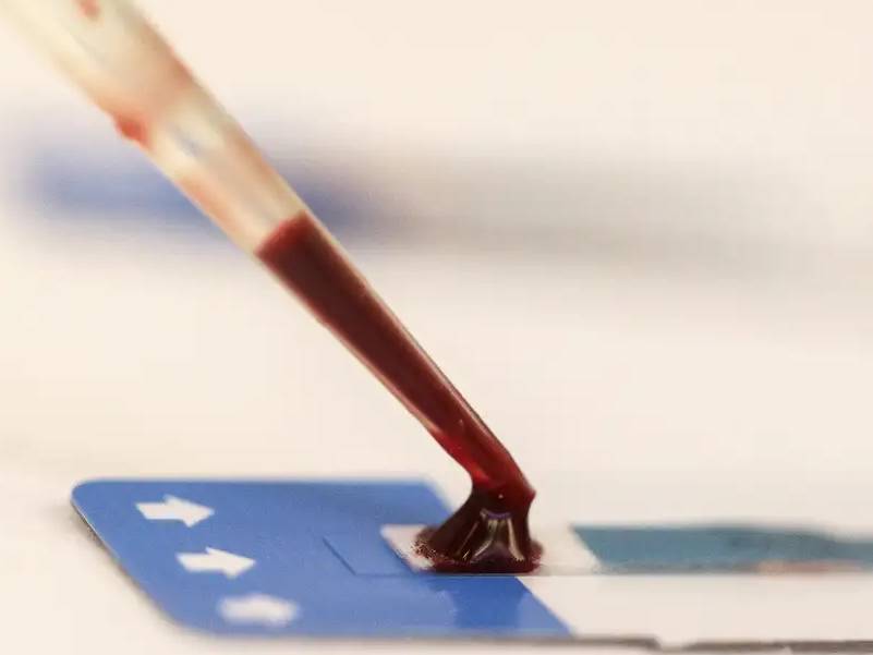 Estudo inédito da Fiocruz pode ampliar prevenção de HIV entre jovens