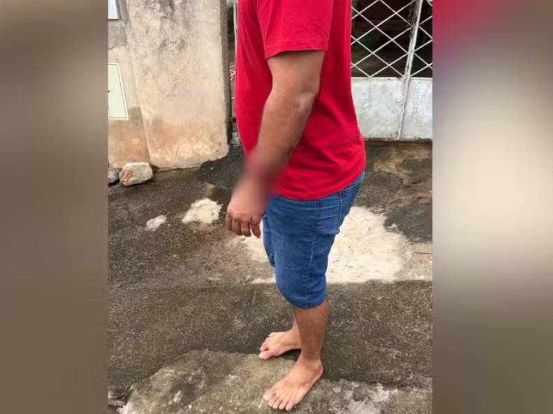 Ataque de pitbulls deixa irmãs feridas em Álvares Machado